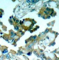 FAK (Ab 861) Antibody