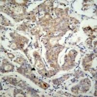 BAD (Ab 155) Antibody