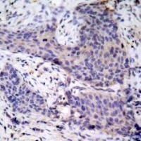 BAD (Ab 136) Antibody