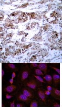 BCL 2 (Ab 70) Antibody