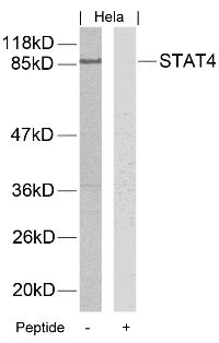 STAT4 (Ab 693) Antibody