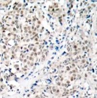 Myc (Ab 358) Antibody