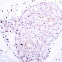 NFkB p105 / p50 (Ab 907) Antibody