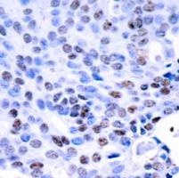 NFkB p105 / p50 (Ab 337) Antibody