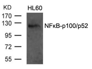 NFkB p100 / p52 (Ab 870) Antibody