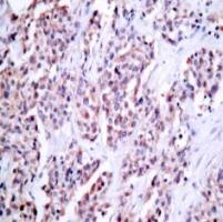 NFkB p100 / p52 (Ab 870) Antibody