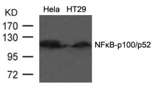 NFkB p100 / p52 (Ab 866) Antibody