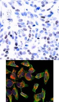 NFkB p100 / p52 (Ab 866) Antibody