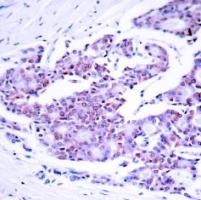 NFkB p65 (Ab 468) Antibody