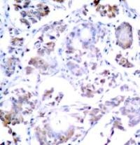 NFkB p65 (Ab 254) Antibody