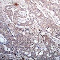 IkB beta (phospho Ser23) Antibody