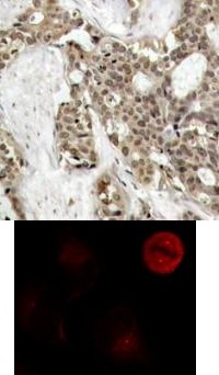 p44 / 42 MAP Kinase (phospho Tyr204) Antibody
