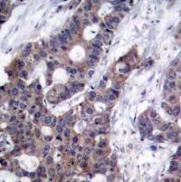 Stathmin 1 (phospho Ser16) Antibody