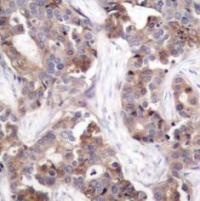 Stathmin 1 (phospho Ser25) Antibody