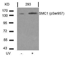 SMC1 (phospho Ser957) Antibody