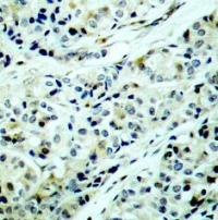 HDAC5 (phospho Ser498) Antibody