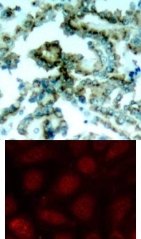PKCbeta (phospho Thr641) Antibody