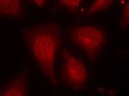 HDAC8 (phospho Ser39) Antibody