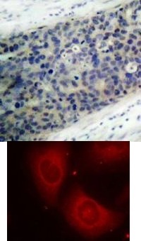LIMK2 (phospho Thr505) Antibody