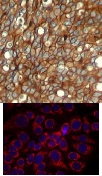 HER2 (phospho Tyr1248) Antibody