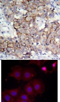 HER2 (phospho Tyr877) Antibody