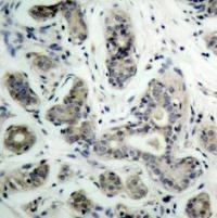 BAD (phospho Ser136) Antibody