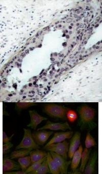 PTEN (phospho Ser380 / Thr382 / Thr383) Antibody
