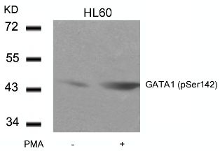 GATA1 (phospho Ser142) Antibody