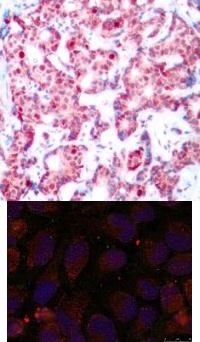 GATA1 (phospho Ser142) Antibody