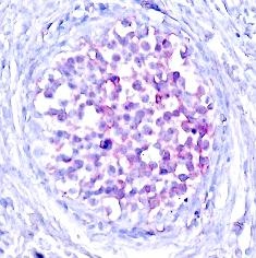 Raf1 (phospho Ser259) Antibody
