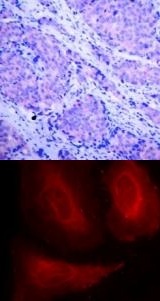 PDK1 (phospho Ser241) Antibody