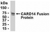 CARD14 Antibody