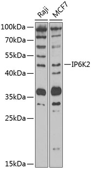 IP6K2 Antibody