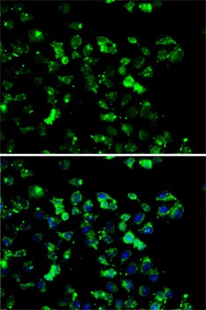 RBBP6 Antibody