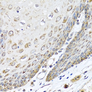 DEDD Antibody