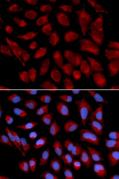 KRT7 Antibody