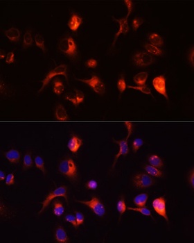 TOR1A Antibody