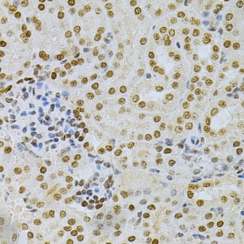 DKC1 Antibody