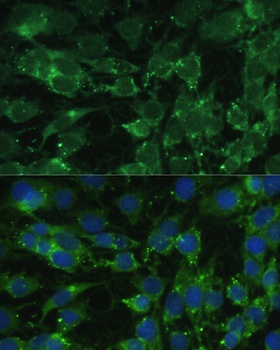 BLOC1S3 Antibody