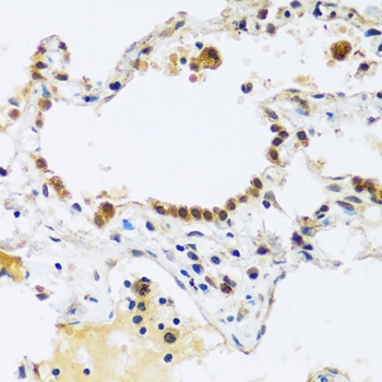 ARL6IP4 Antibody