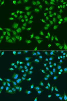 RPS6KB1 Antibody