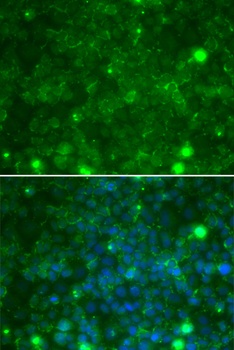 TIMP3 Antibody