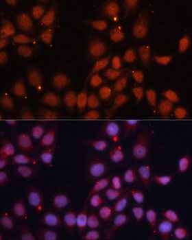 CDK11B Antibody