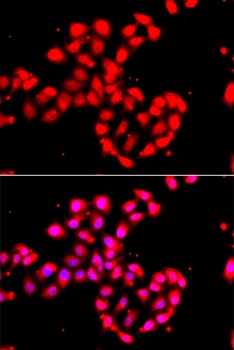 CAMK1D Antibody