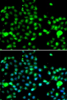 IP6K2 Antibody