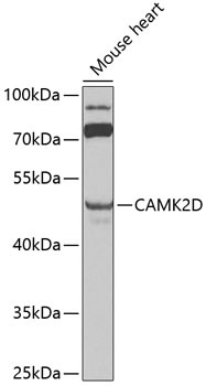 CAMK2D Antibody