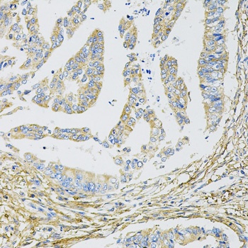 CDKN2A / p16INK4a Antibody
