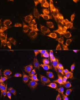 ACAT1 Antibody