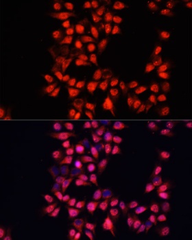 ADAM10 Antibody