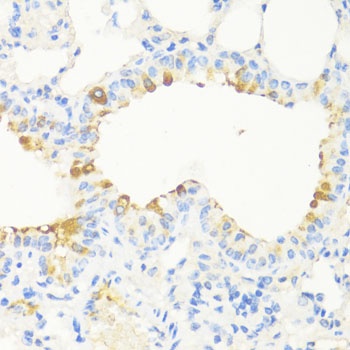 MAPRE3 Antibody